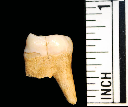 FF Tooth 2