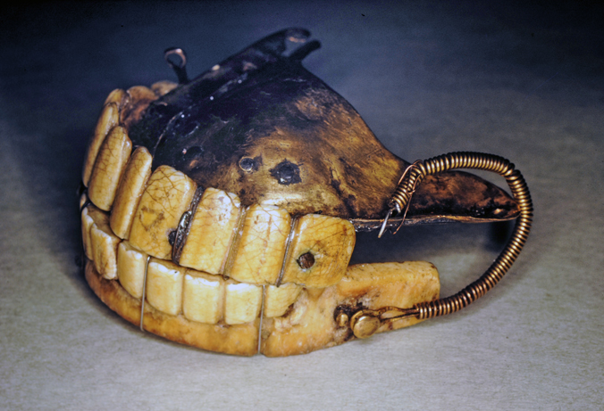 George Washington - Full Dentures, Now Incomplete Set